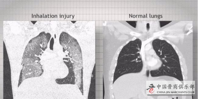 中国向美方提了四个要求！问：是不是美国人把新冠带到中国