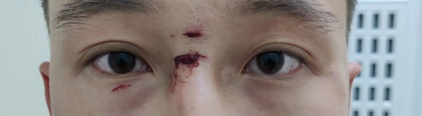 太原又现“唐山烧烤打人事件”，看派出所这般处理正义何在？