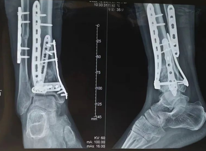 微信截图_20230322103720