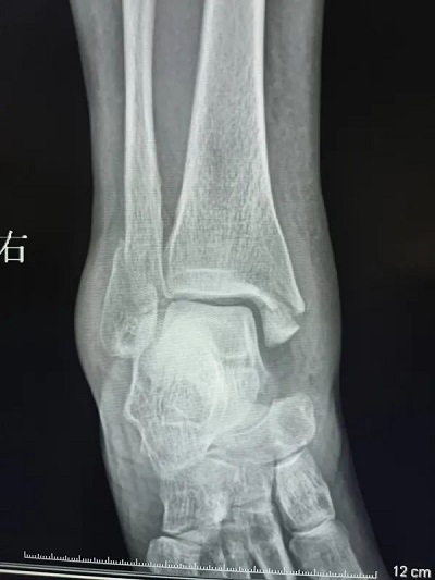 微信图片_20230322103746