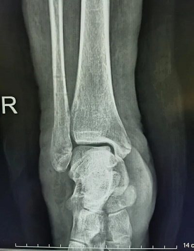 微信图片_20230322103749