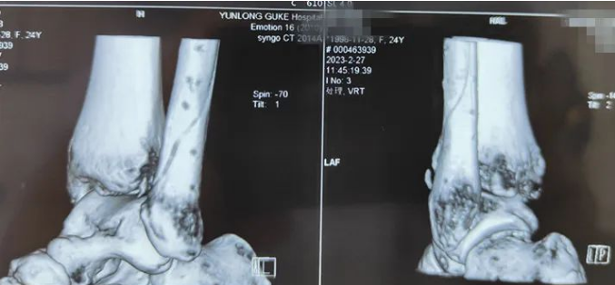 微信截图_20230322103740