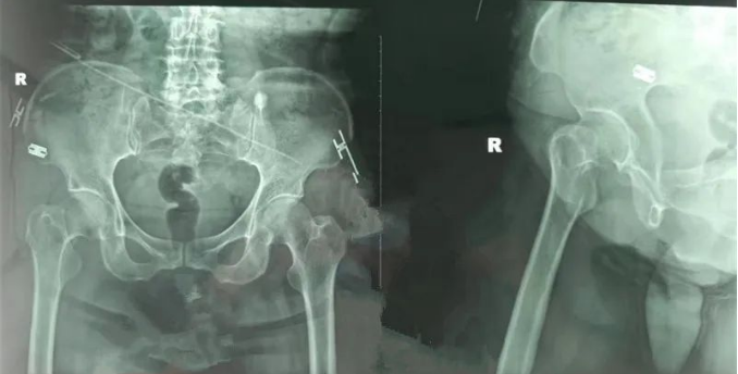 微信截图_20230322104235