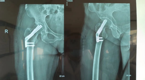 微信截图_20230322104259