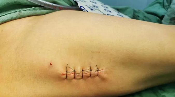 微信截图_20230322104307