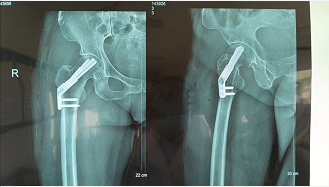 微信截图_20230330104249