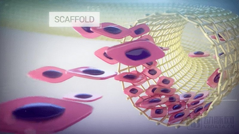 费森尤斯、远大医药数亿布局,密集融资的组织工程成为风口?