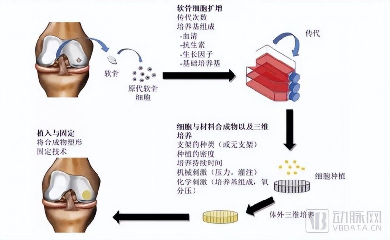 费森尤斯、远大医药数亿布局,密集融资的组织工程成为风口?