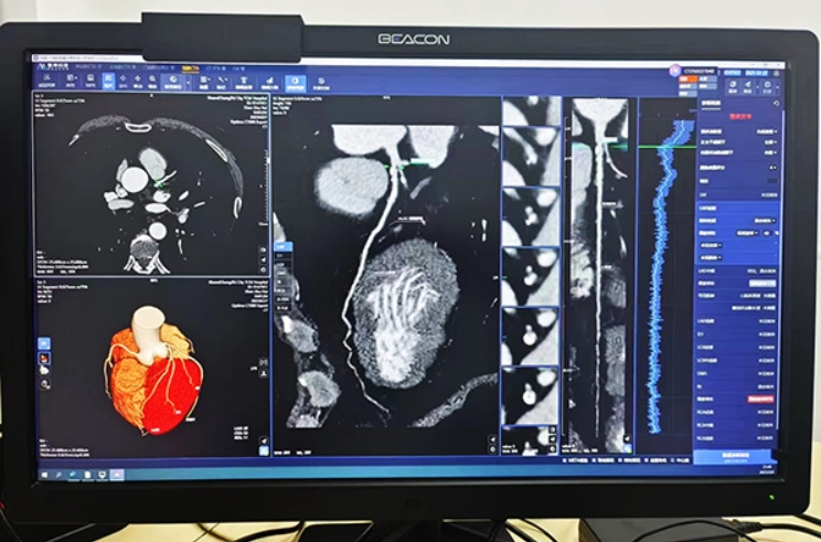 微信截图_20250307092256