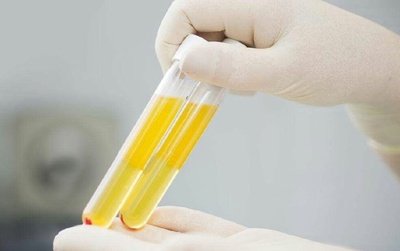 心向患者传递温情，蔡倩医生善暖人心：3个信号说明肾病正在好转，快来看看你有没有？