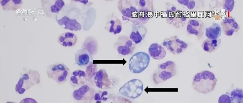 微信截图_20250826110215