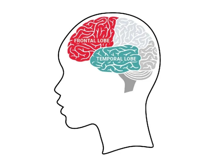 他24岁，刚刚死于痴呆