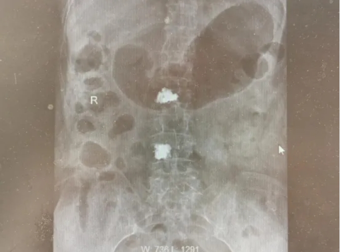 微信截图_20260331172633